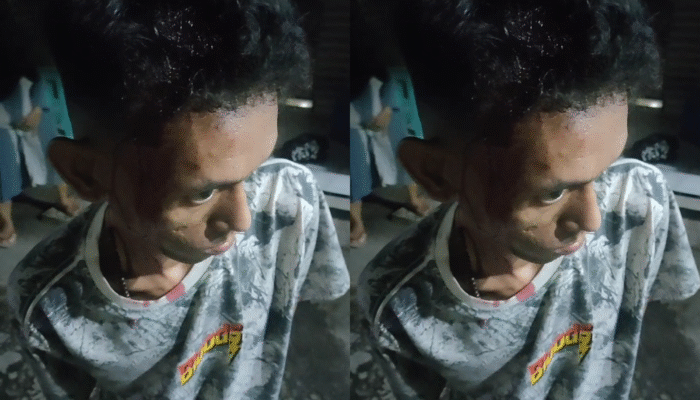Gagal Rampas Motor, Dua Pelaku Bacok Warga Leces Probolinggo di Tengah Malam