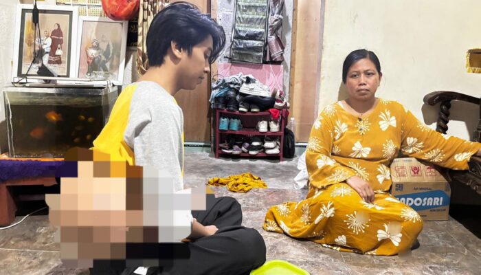 Pemuda di Probolinggo Hadapi Tumor di Belakang Tubuhnya dan Butuh Biaya